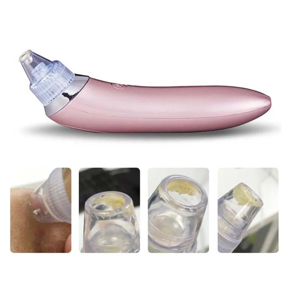 Vacuum Blackheads Remover