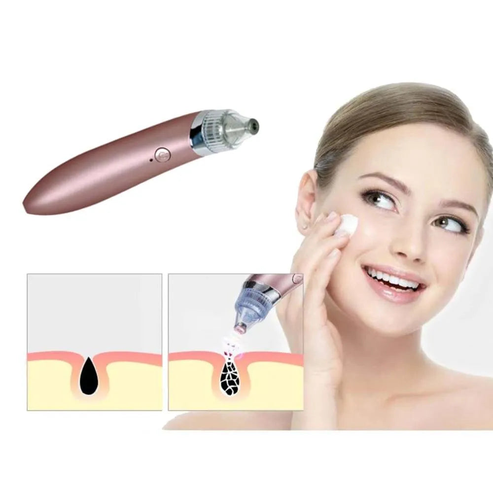 Vacuum Blackheads Remover